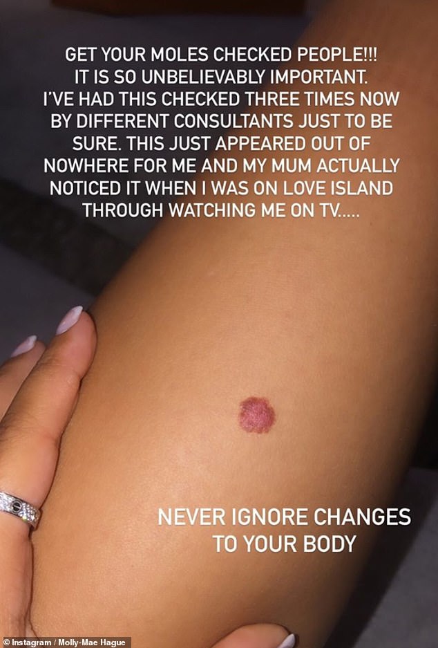 Fear: The Island of Love star has revealed that she has visited the doctor three times before noticing believers that Mark was found to be non-cancerous after noticing the calf's mole.